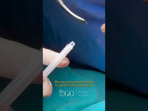 Behind the Scenes: A Day in Pentalift Surgery with Assoc. Prof. Dr. Güncel Öztürk