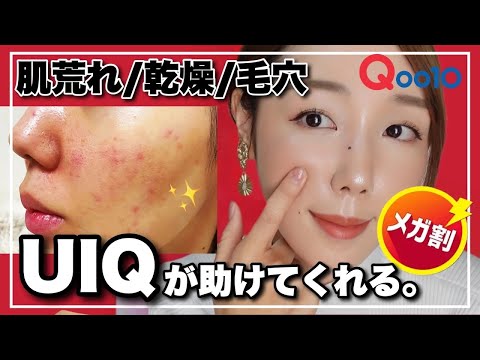 【Qoo10メガ割】ガサガサ乾燥肌の必須アイテム‼️肌の潤いを守る【UIQ シールドデュオ】