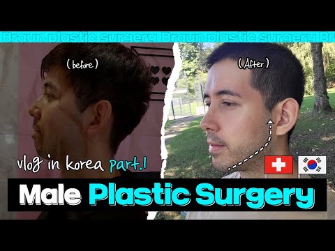 Male plastic surgery in Korea │Genioplasty, Shaving jawline, Facial liposuction