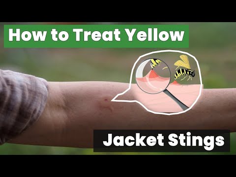 How to Treat Yellow Jacket Stings – Expert Tips You Need to Know!