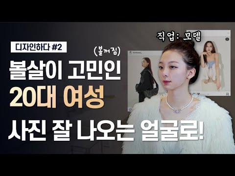 ❗❗보정 아님❗❗ 티 안나게 인스타 여신 되기 │ 강남 피부과 시술 실제 후기 │ 필러 시술 브이로그 코 필러 턱 필러 지방 분해 주사 심부볼