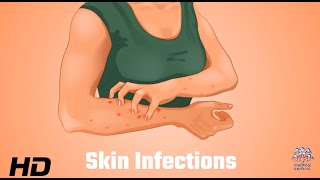 Skin Infections Uncovered: What Your Dermatologist Wants You to Know