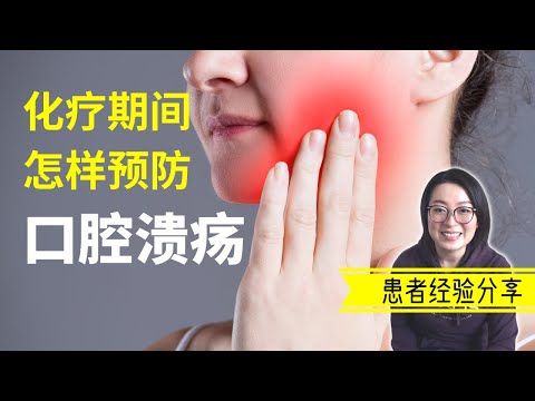 How to Prevent Chemo Mouth Ulcers | 如何预防化疗导致的口腔溃疡 | 癌症治疗前该知道的事 | 癌症患者怎么吃 | 癌症经验 | 我的癌症传