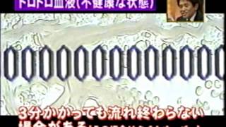 血液流動性検査（血液サラサラ検査）のわかりやすい説明