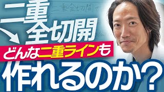 二重全切開であればどんな二重ラインでも作ることが可能！？