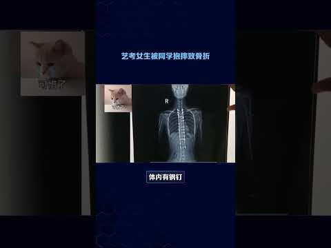 艺考女生被同学抱摔致骨折