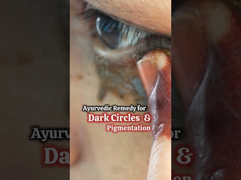 Ayurvedic Home-remedy for Dark Circles and pigmentation/ Try this for  1 week👆 #shorts