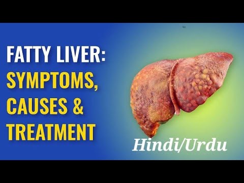 Fatty Liver: Causes and Treatment | फैटी लीवर के कारण और उपचार | فیٹی لیور کی وجوھات و علاج #health