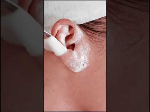 HOW TO CLEAN EAR, SPECIALLY FOR GIRLS👂