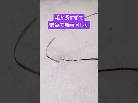 緊急で動画回しました #毛抜き #埋没毛