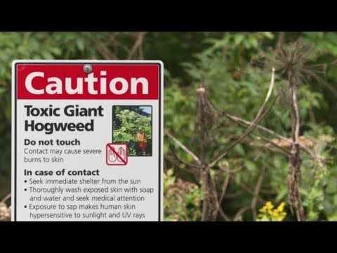 Alert! Giant Hogweed　burns　blindness　Virginia　USA Trend 1st 　日本未上陸