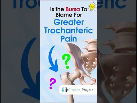 Greater Trochanteric Pain #anatomy #physiotherapy #physicaltherapy #gtps #hippain