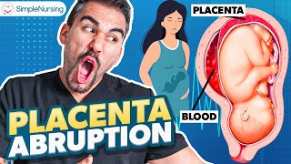 Placental Abruption Symptoms, Causes, Nursing Interventions | NCLEX Tips