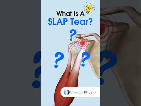 SLAP Tear #physicaltherapy #physiotherapy #shoulder #anatomy