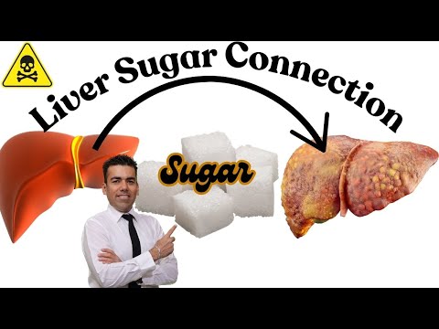 Liver Sugar connection! What are different sugars and how to effect your liver! Let's get Healthy!