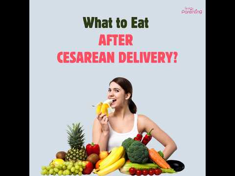 Foods To Eat After C-Section | Diet After C-Section Delivery | What To Eat After Cesarean Section