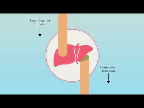 How to make phototherapy more effective?