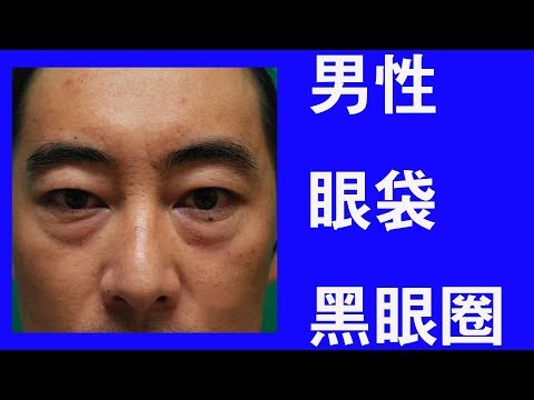 男性眼袋黑眼圈