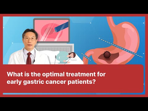 10 What is the optimal treatment for early gastric cancer patients?