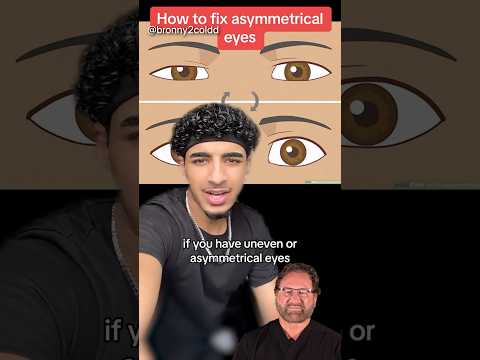 How to FIX Asymmetrical Eyes - Surgeon Reacts