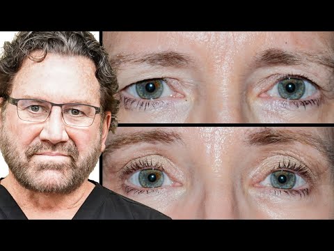 Best Ways To Treat Under-Eye Aging