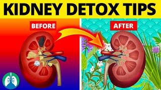 7 Ways to Detox and Cleanse Your Kidneys Naturally