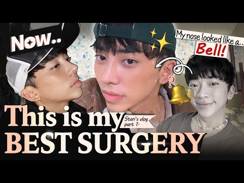 MY NOSE IS PERFECT NOW!│Stan's LIFE-CHANGING rhinoplasty experience at BRAUN! (Part 1)