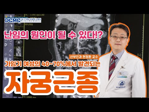 가임기 여성에게 흔하게 나타나는 양성질환 '자궁근종' 하지만 난임의 원인이 될 수 있다는데?!(feat. 산부인과 현정환 교수)[대구가톨릭대병원]