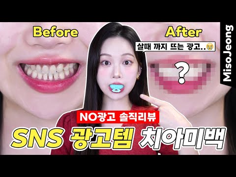 Dental whitening is too expensive. Korean self-teeth whitening product review