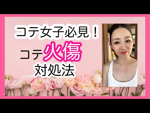 コテ女子必見！コテ火傷対処法