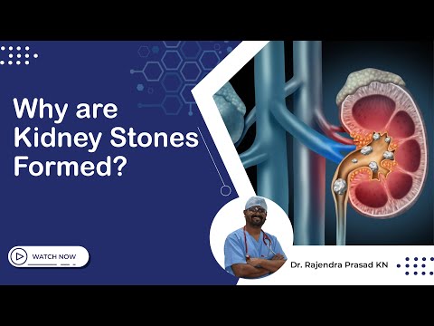 Why are Kidney Stone formed | Dr Rajendra Prasad K N | Sanyra Multi Speciality Hospital