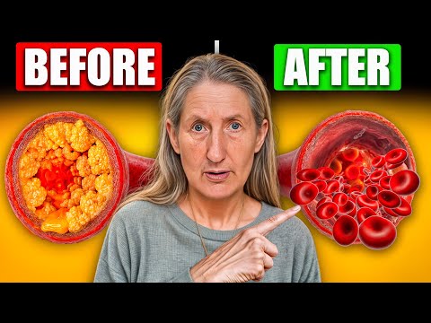 50+? Your Arteries May Be Clogged—Eat This Now To Clear Them! | Barbara O'Neill