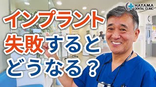 インプラント治療が失敗するとどうなるのか？【千葉県柏市 JR「柏駅」徒歩14分 葉山歯科医院】