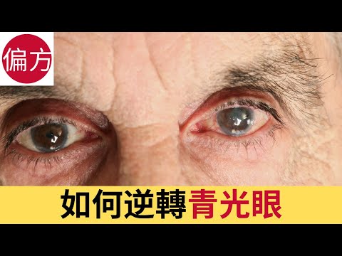 如何逆轉青光眼