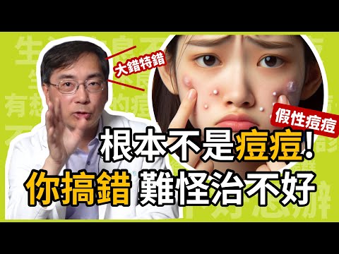 大錯特錯！這根本不是痘痘，搞錯當然治不好！三種容易與痘痘搞混的皮膚病！