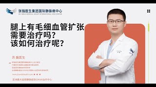 腿上有毛细血管扩张症（红血丝、蜘蛛静脉）需要治疗吗？该如何治疗呢？│#张强医生集团 #chiva #静脉曲张 #varicoseveins #DrSmileMedicalGroup