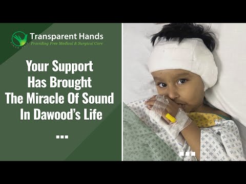 Dawood underwent a Successful Cochlear Implant Surgery