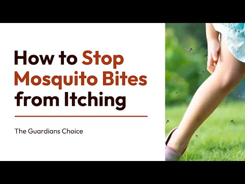 4 Ways to Stop Mosquito Bites from Itching | How to Stop Mosquito Bites from Itching