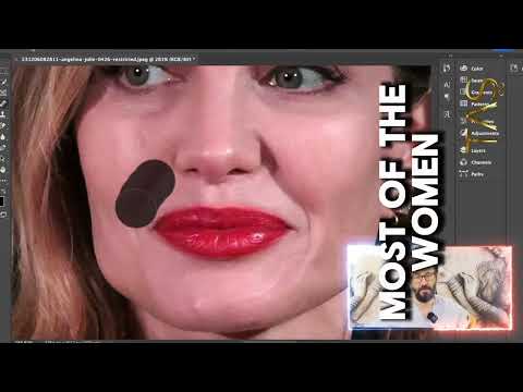 Angelina Jolie Facelift Surgery with Prof.Dr.Suleyman Tas