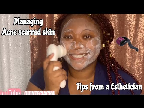 Nighttime Skincare Routine for Acne Scarred and Hyperpigmentation skin| Esthetician's Guide Series 1