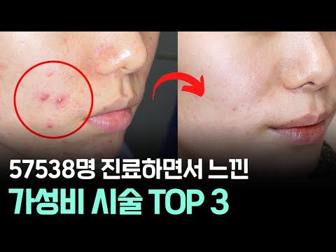 TOP 3 Best Value Skin Procedures from Dermatologist with Over 50,000 Patients