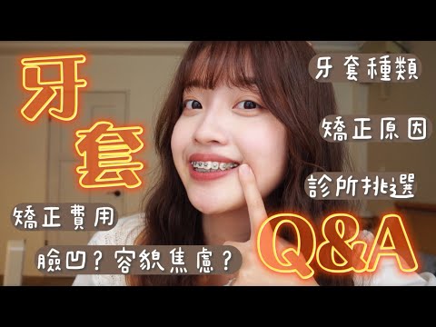 牙套Q&A：矯正原因、費用、牙套種類、診所挑選、臉凹？容貌焦慮？｜恩琪