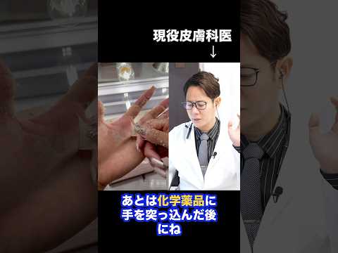 Japanese Dermatologist Explains Symptoms of Peeling Skin on the Hands