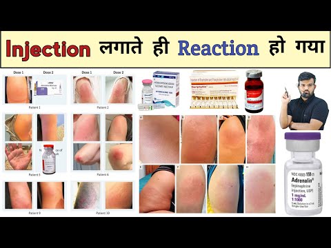 Injection Reaction | Medicine Reaction | Reaction Treatment | Treatment | Medicine | Pharmacy | दवाई