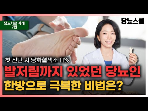 [당뇨치료 사례 7편] 당화혈색소 11%, 발저림도 극복가능! | 당뇨문의 : 1644-5178