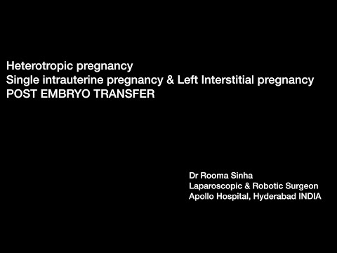 Laparoscopic management Heterotropic (ectopic) pregnancy Dr Rooma Sinha Apollo Hospitals, Hyderabad