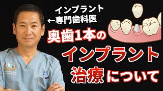 "奥歯一本のみをインプラント治療" する時の治療期間や費用。インプラント専門歯科医が解説します。