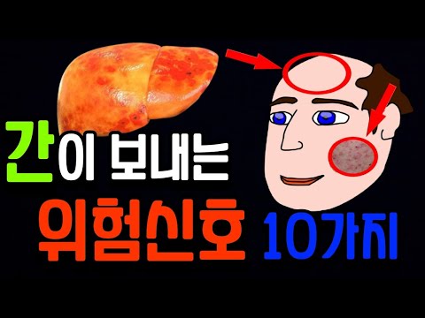 간이 안좋으면 반드시 나타나는 위험신호 증상 | 간이 안좋을때 위험을 알리기 위해 나타나는 증상