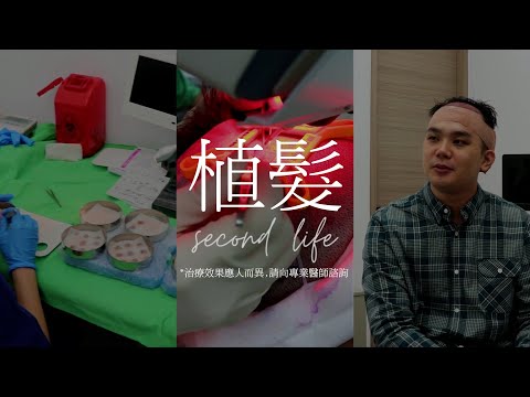 植髮 Second Life-型男植髮心得訪談-極緻美型·文心極緻皮膚科診所整形手術-林子鈞醫師：台中植髮_台中植眉_台中植鬍_台中掉髮_台中禿頭