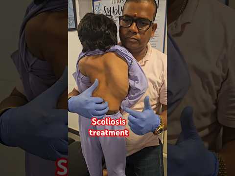 Scoliosis treatment  #drrajneeshkant